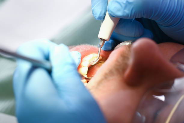 Best Emergency Treatment for Dental Infections or Abscesses in Edburgh, IN