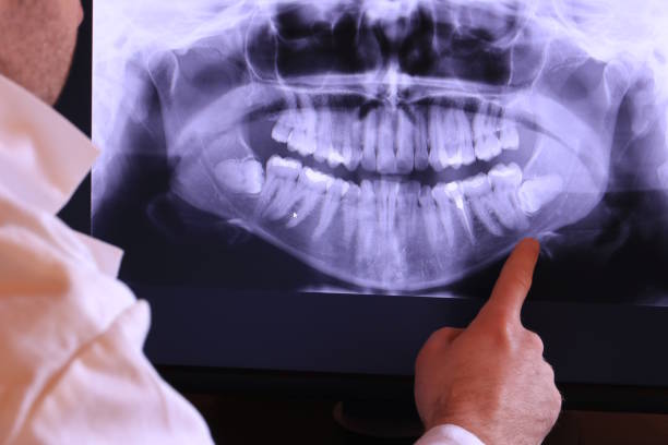Best Emergency Root Canal Treatment in Edburgh, IN
