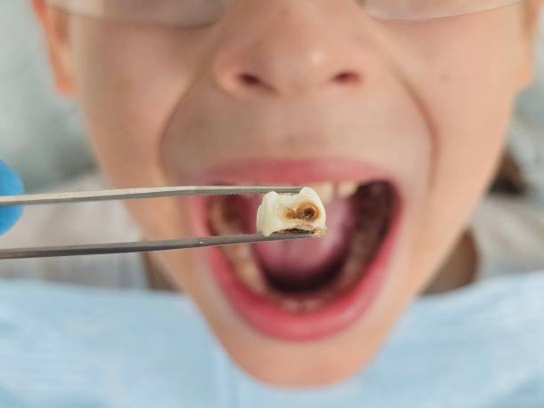 Best Emergency TMJ Treatment in Edburgh, IN